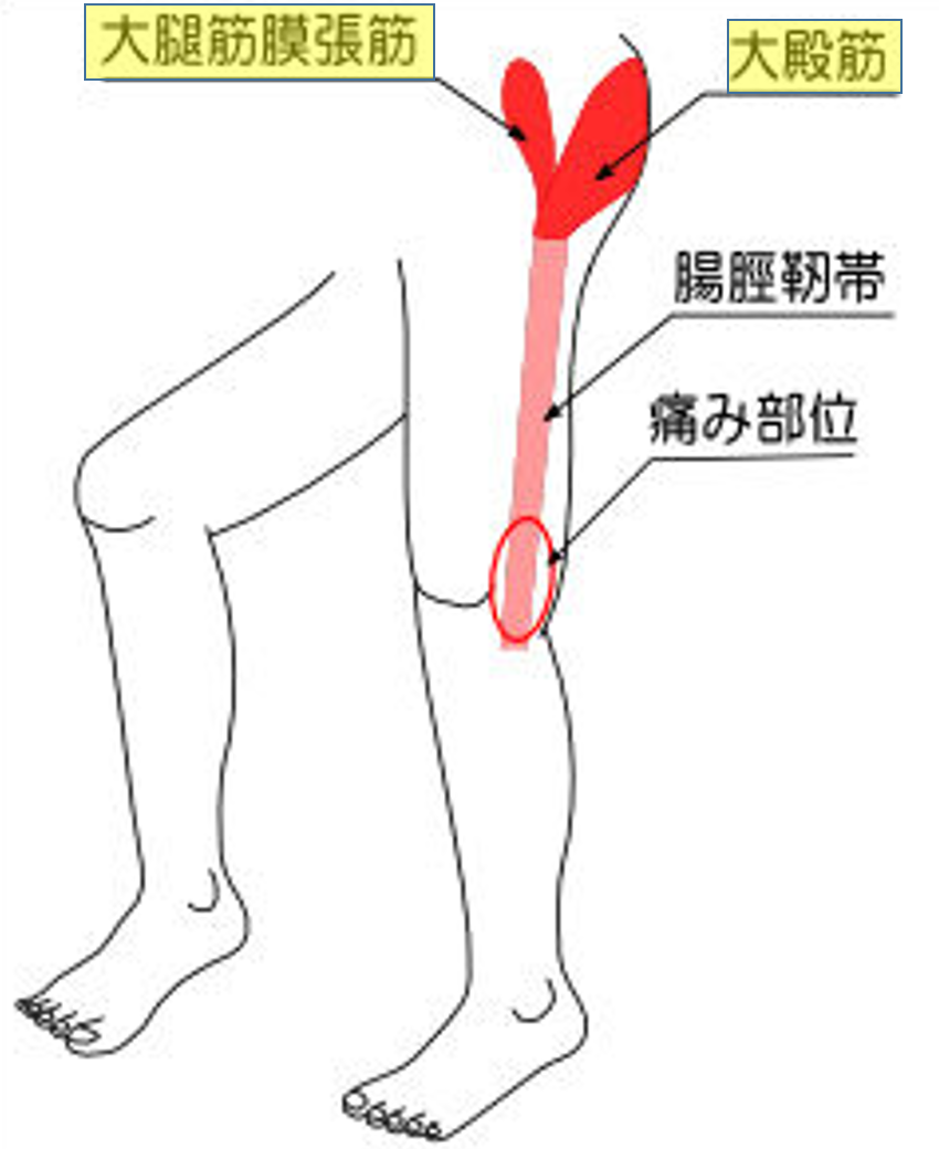 腸脛靭帯　大殿筋　大腿筋膜張筋